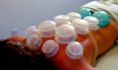 Cupping Massage Mastery